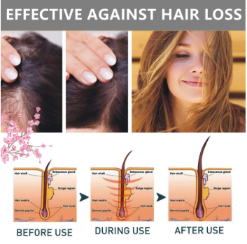 Sakura Japanese Shampoo For Hair Loss